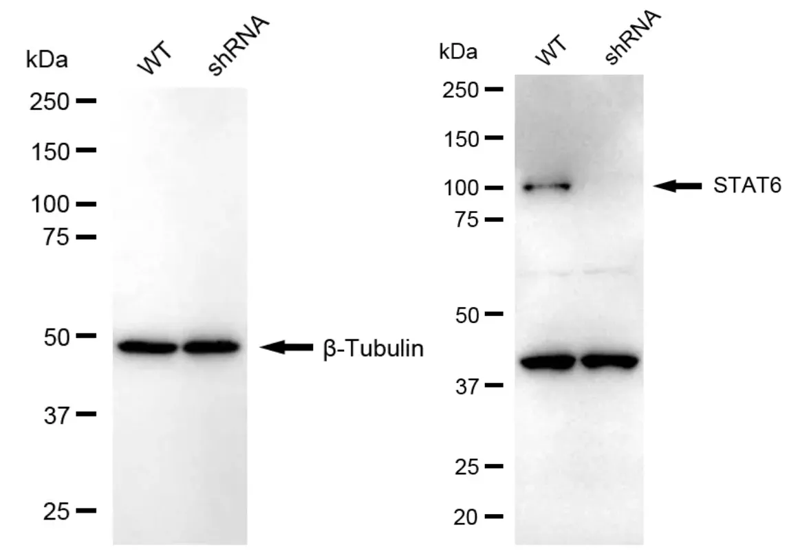 KD-Validated STAT6 Recombinant Rabbit Monoclonal Antibody