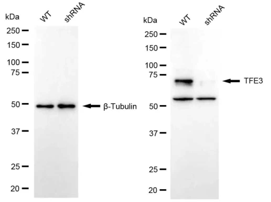 KD-Validated TFE3 Recombinant Rabbit Monoclonal Antibody