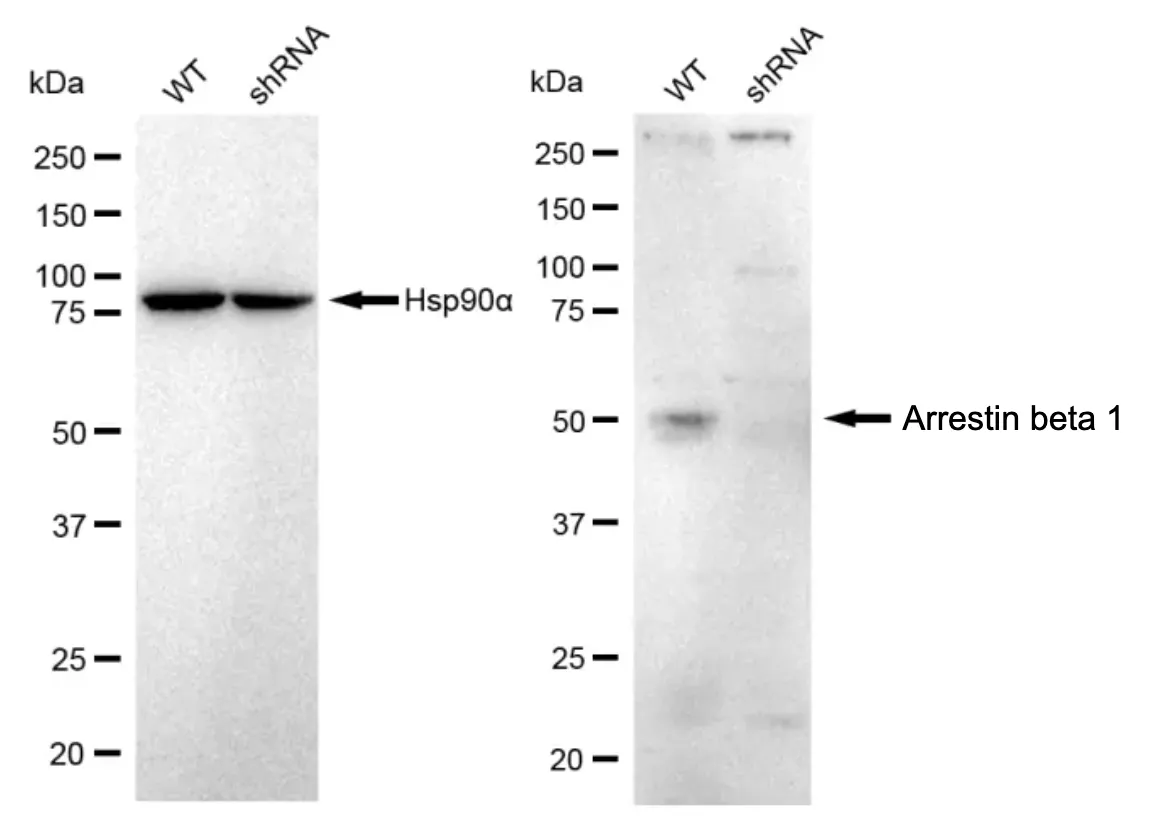 KD-Validated Arrestin Beta 1 Recombinant Rabbit Monoclonal Antibody