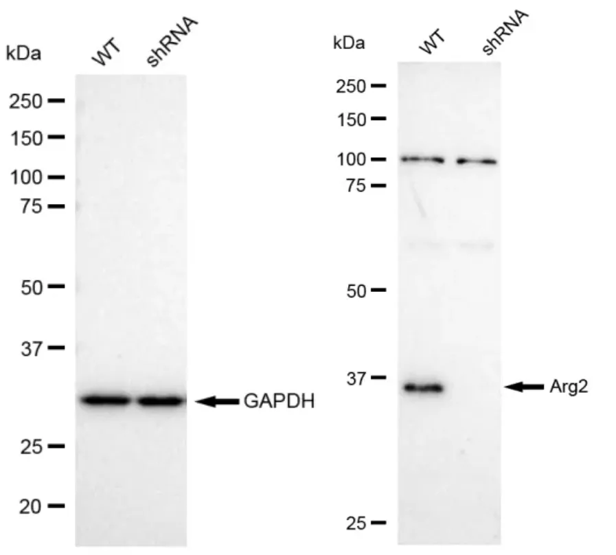 KD-Validated Arg2 Recombinant Rabbit Monoclonal Antibody