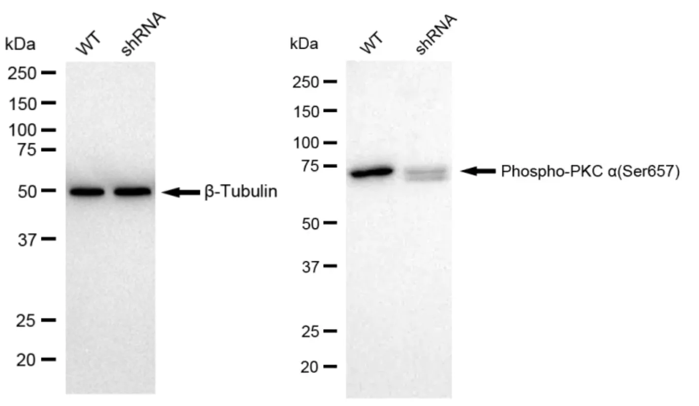 KD-Validated Phospho-PKC Alpha (Ser657) Recombinant Rabbit Monoclonal Antibody