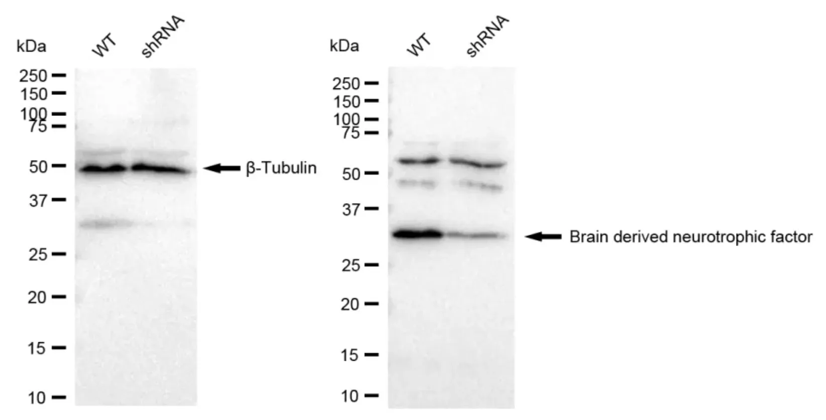 KD-Validated Brain Derived Neurotrophic Factor Recombinant Rabbit Monoclonal Antibody