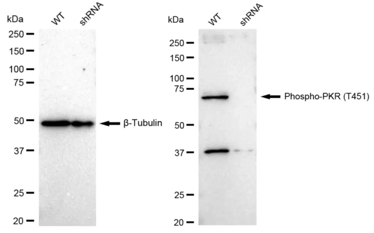 KD-Validated Phospho-PKR (T451) Recombinant Rabbit Monoclonal Antibody