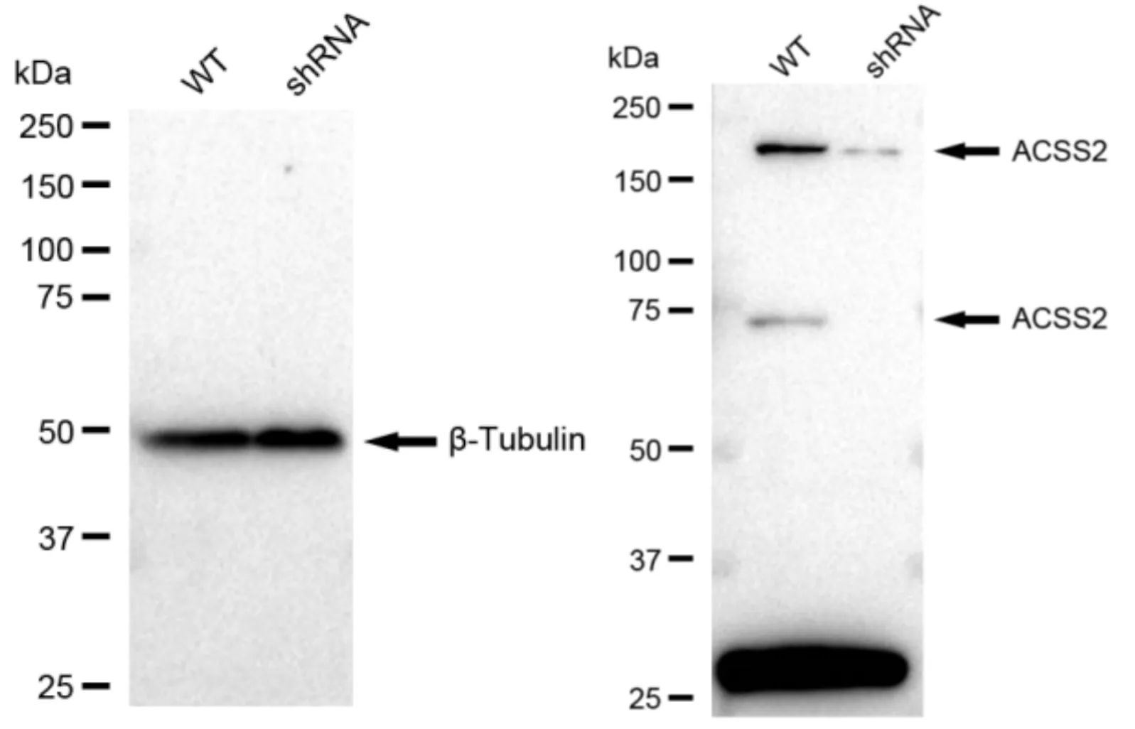 KD-Validated ACSS2 Recombinant Rabbit Monoclonal Antibody
