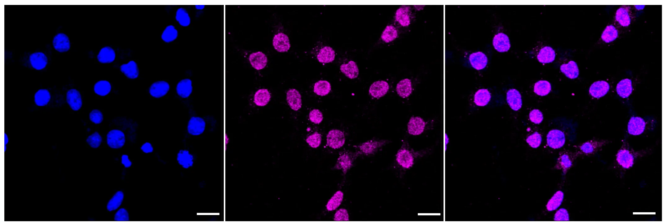 Immunocytochemistry(ICC) - KD-Validated CD163 Recombinant Rabbit Monoclonal Antibody KVAb00239