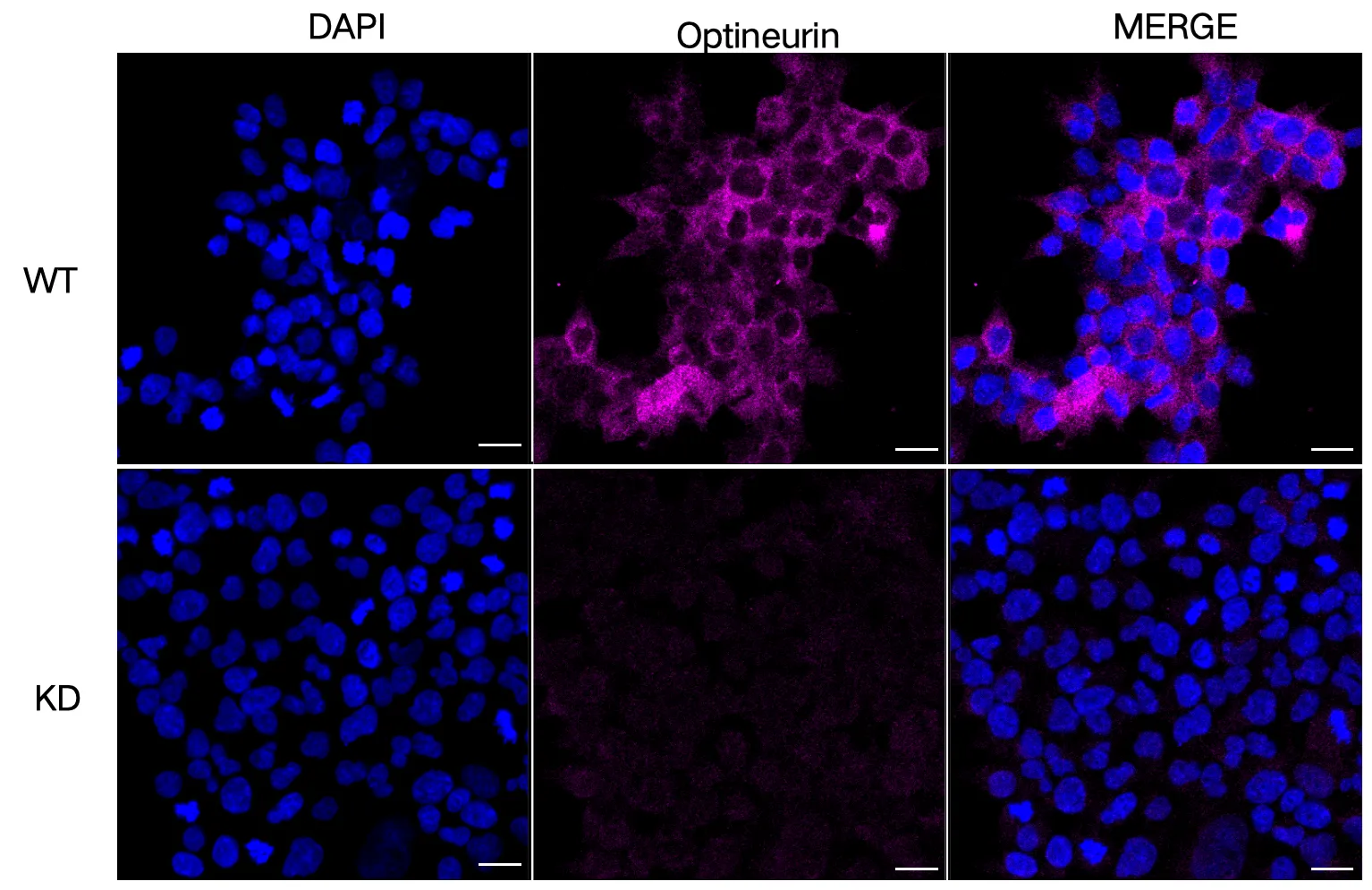 Immunocytochemistry(ICC) - KD-Validated Optineurin Recombinant Rabbit Monoclonal Antibody KVAb00307