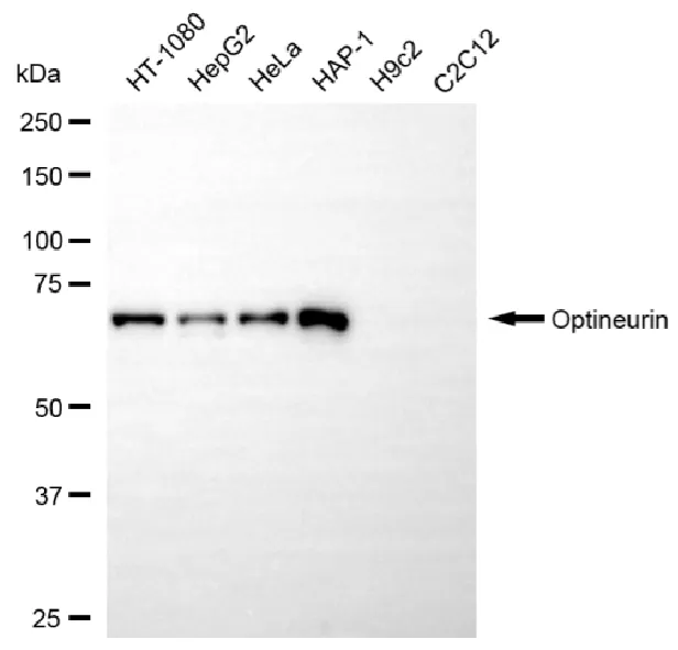 WesternBlot(WB) - KD-Validated Optineurin Recombinant Rabbit Monoclonal Antibody KVAb00307