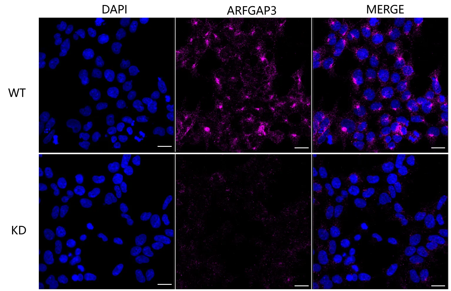 Immunocytochemistry(ICC) - KD-Validated ARFGAP3 Mouse Oligoclonal Antibody KVAb00354