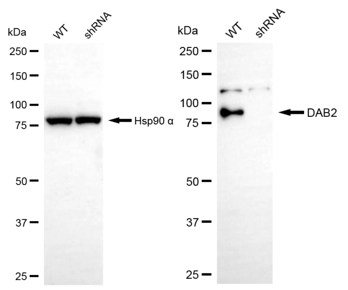 KD-Validated DAB2 Recombinant Rabbit Monoclonal Antibody
