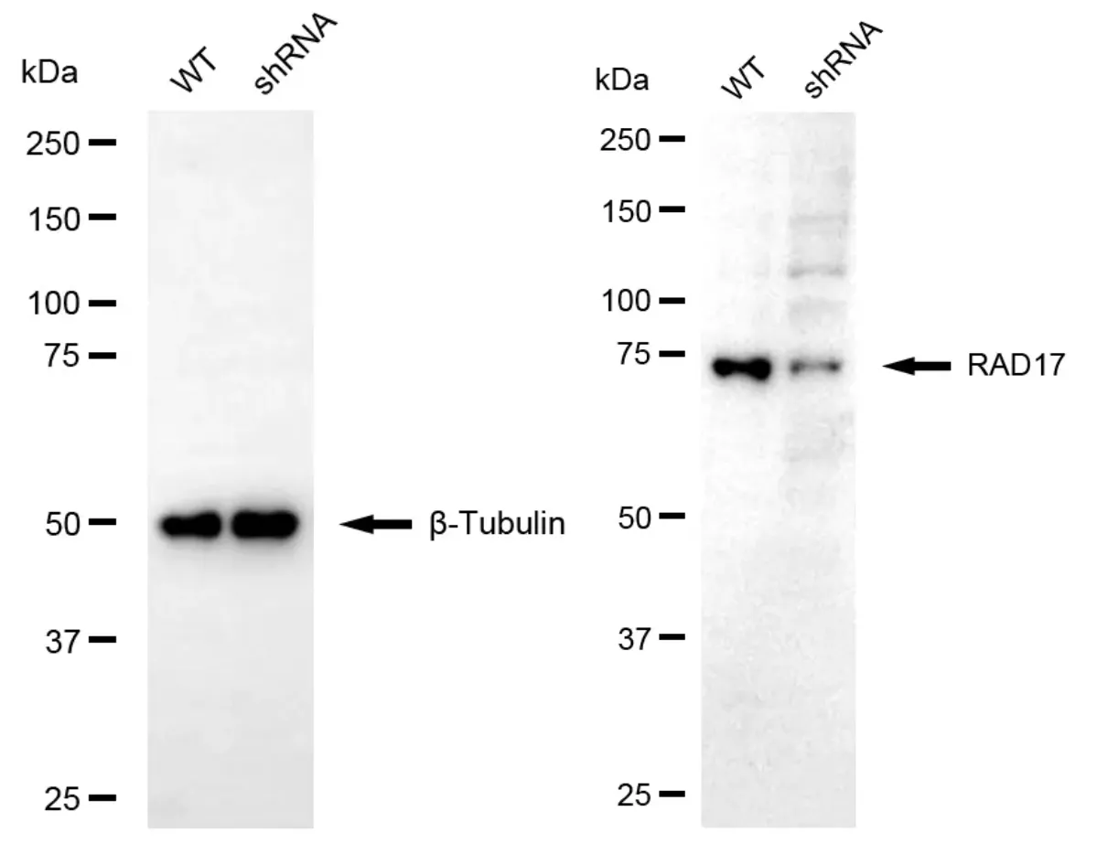 KD-Validated RAD17 Rabbit Polyclonal Antibody
