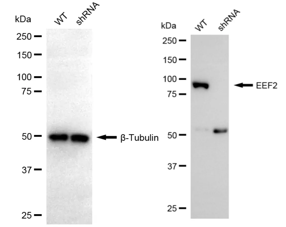 KD-Validated EEF2 Rabbit Polyclonal Antibody