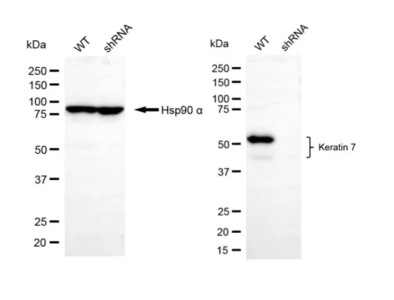 KD-Validated Keratin 7 Rabbit Polyclonal Antibody