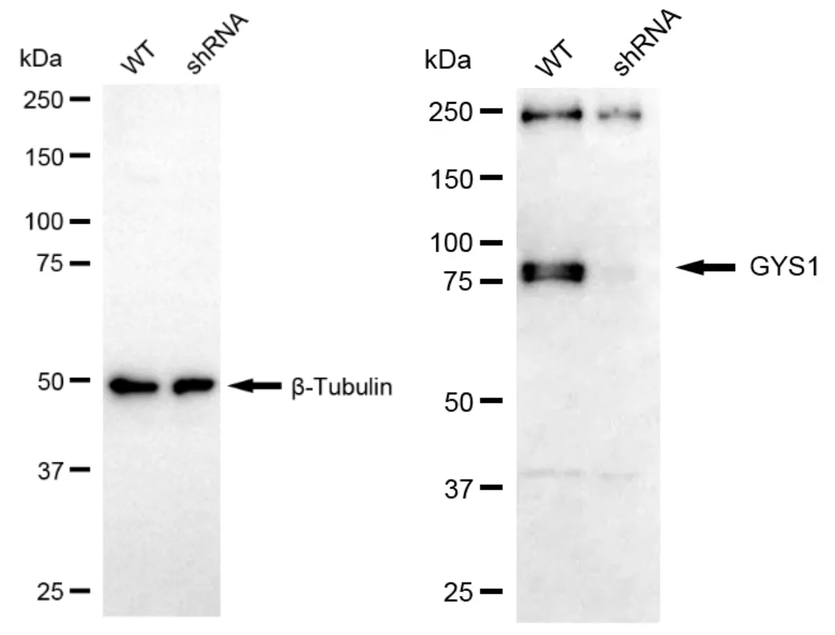 KD-Validated GYS1 Rabbit Polyclonal Antibody