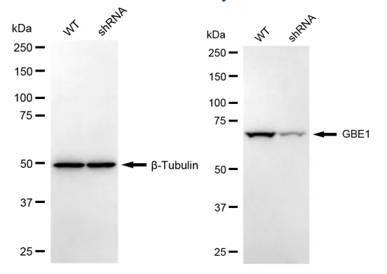 KD-Validated GBE1 Mouse Monoclonal Antibody