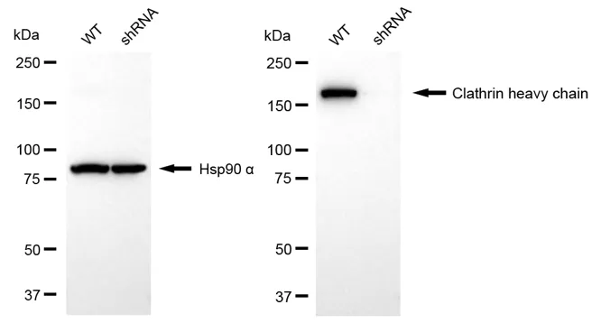KD-Validated Clathrin Heavy Chain Recombinant Rabbit Monoclonal Antibody