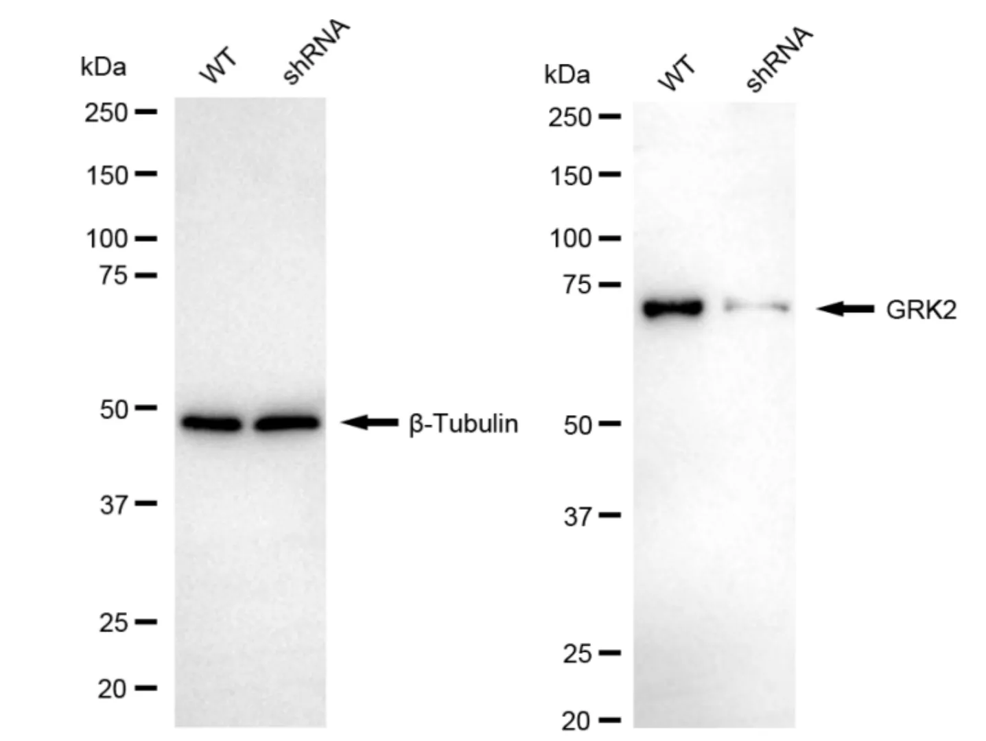 KD-Validated GRK2 Recombinant Rabbit Monoclonal Antibody