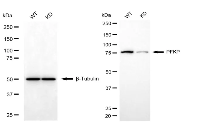 KD-Validated PFKP Mouse Monoclonal Antibody