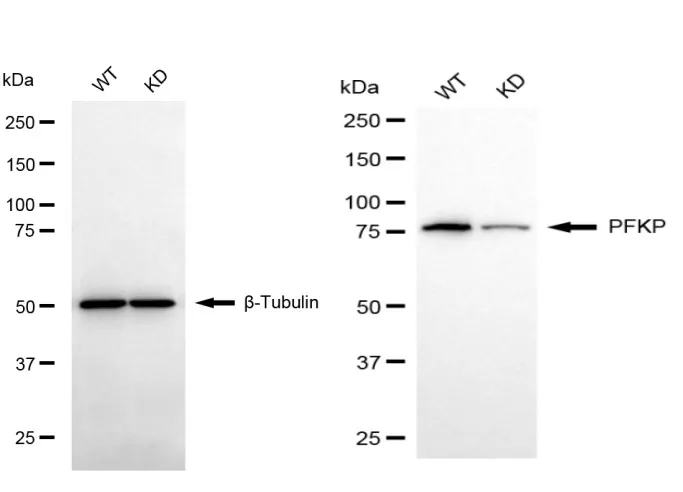 KD-Validated PFKP Mouse Monoclonal Antibody