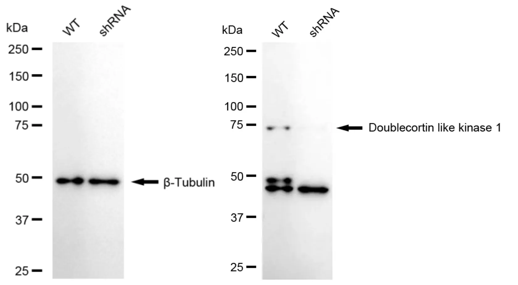 KD-Validated Doublecortin Like Kinase 1 Recombinant Rabbit Monoclonal Antibody