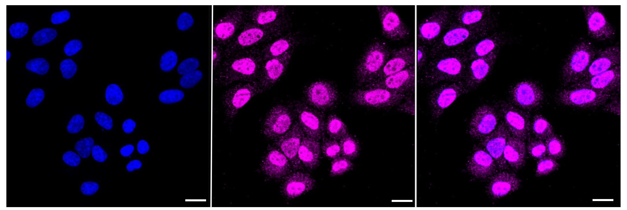 Immunocytochemistry(ICC) - KD-Validated HDAC4 Recombinant Rabbit Monoclonal Antibody KVAb00754