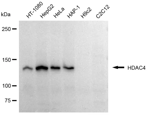 WesternBlot(WB) - KD-Validated HDAC4 Recombinant Rabbit Monoclonal Antibody KVAb00754
