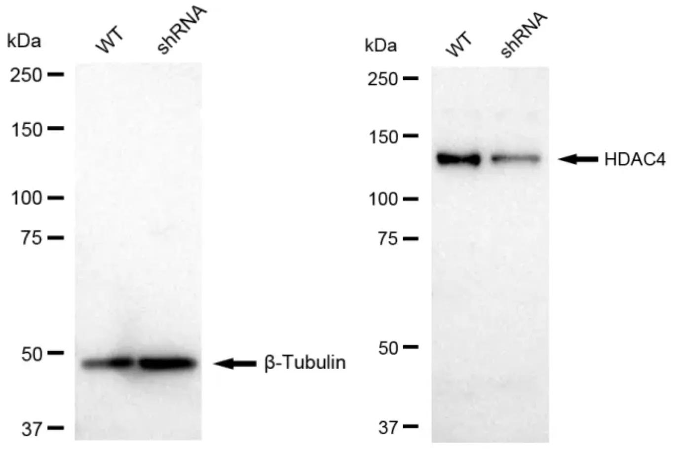 WesternBlot(WB) - KD-Validated HDAC4 Recombinant Rabbit Monoclonal Antibody KVAb00754