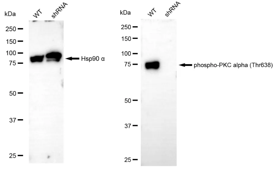 KD-Validated Phospho-PKC Alpha (Thr638) Recombinant Rabbit Monoclonal Antibody