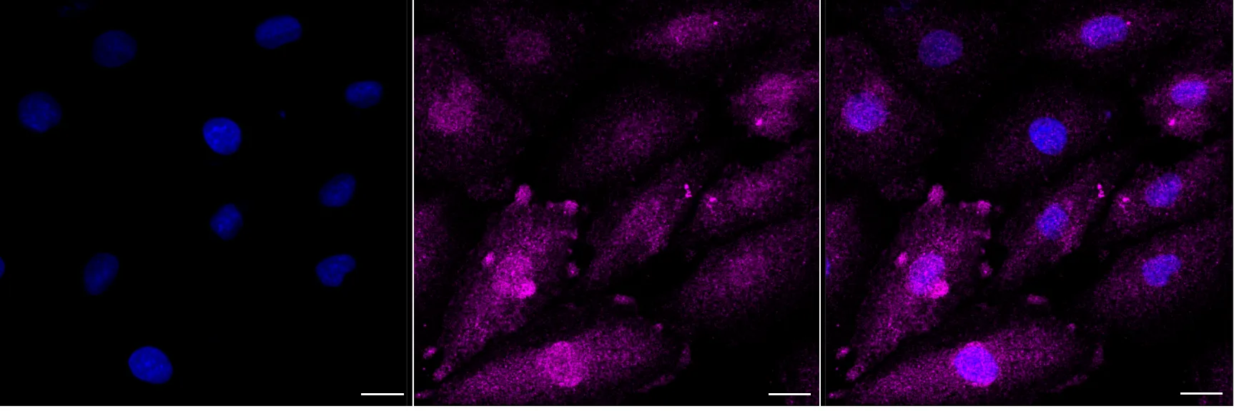 Immunocytochemistry(ICC) - KD-Validated Catalase Recombinant Rabbit Monoclonal Antibody KVAb00799