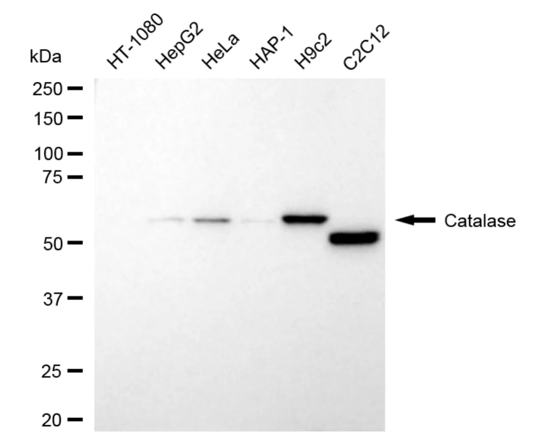 WesternBlot(WB) - KD-Validated Catalase Recombinant Rabbit Monoclonal Antibody KVAb00799