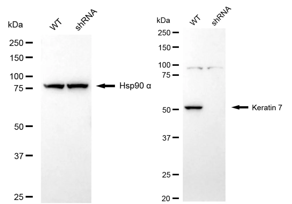KD-Validated Keratin 7 Recombinant Rabbit Monoclonal Antibody
