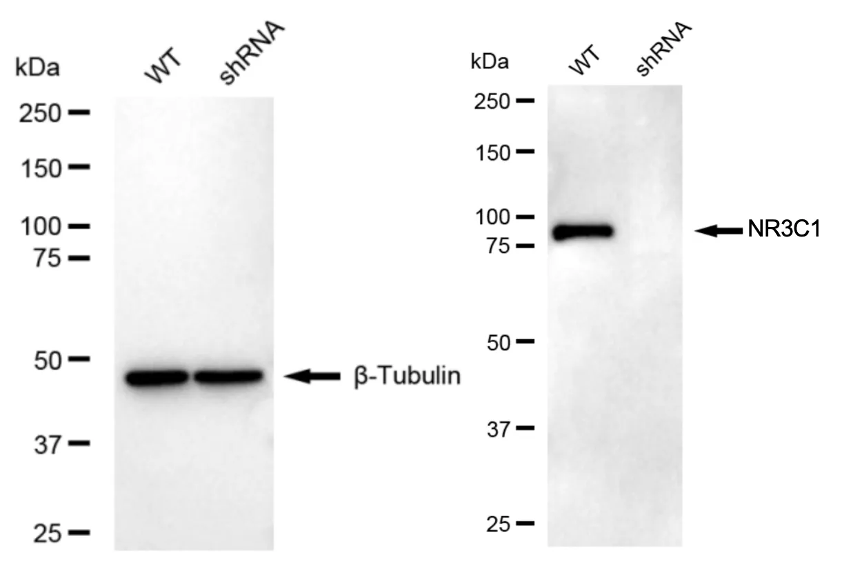KD-Validated NR3C1 Mouse Monoclonal Antibody