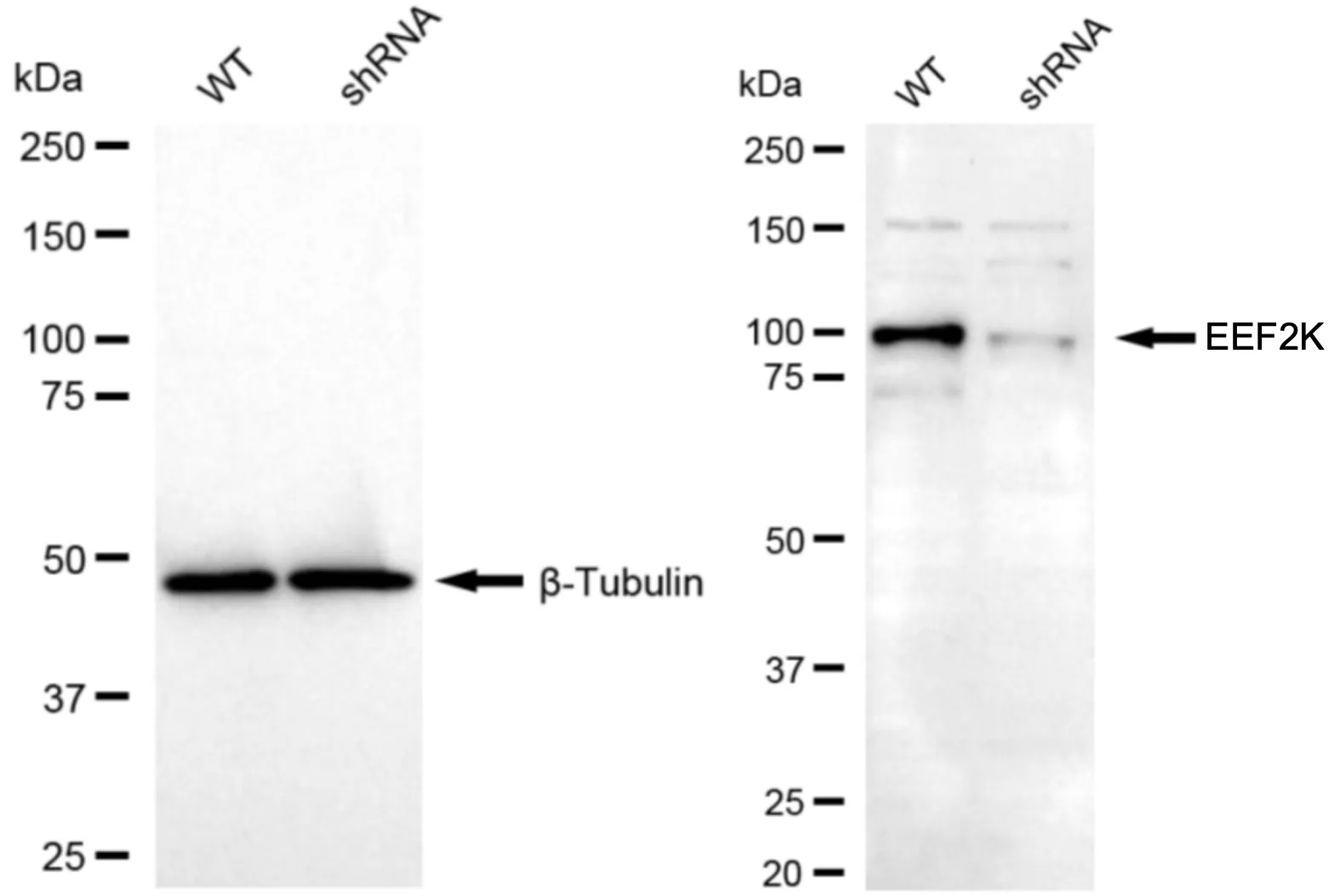 KD-Validated EEF2K Rabbit Polyclonal Antibody