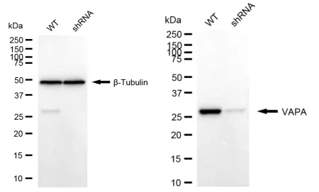 KD-Validated VAMP Associated Protein A Recombinant Rabbit Monoclonal Antibody
