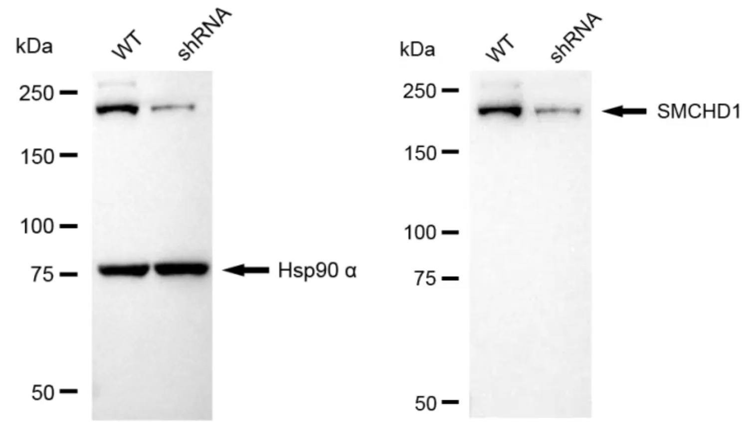 KD-Validated SMCHD1 Recombinant Rabbit Monoclonal Antibody