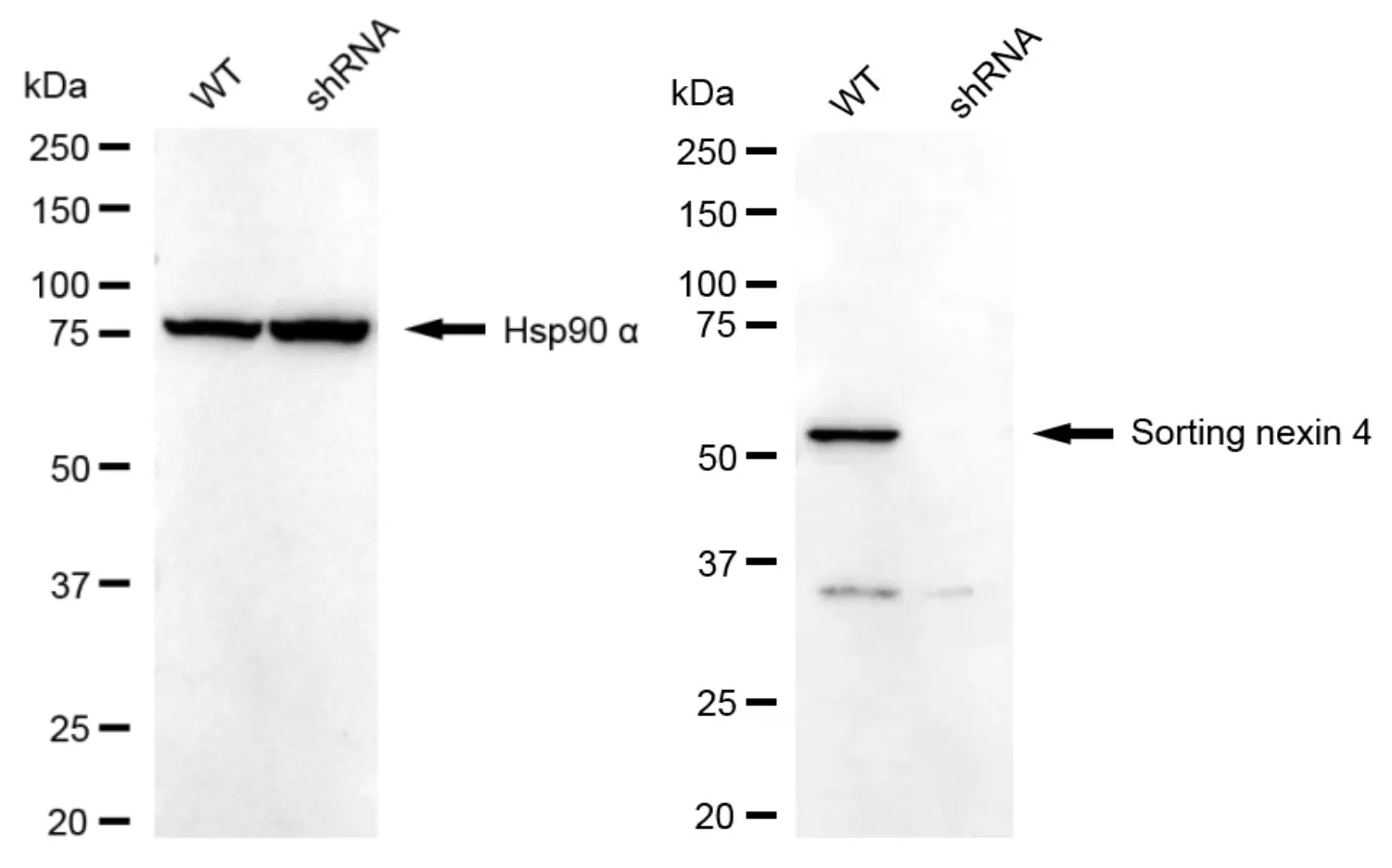 KD-Validated Sorting Nexin 4 Recombinant Rabbit Monoclonal Antibody