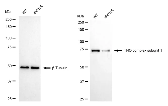 KD-Validated THO Complex Subunit 1 Recombinant Rabbit Monoclonal Antibody