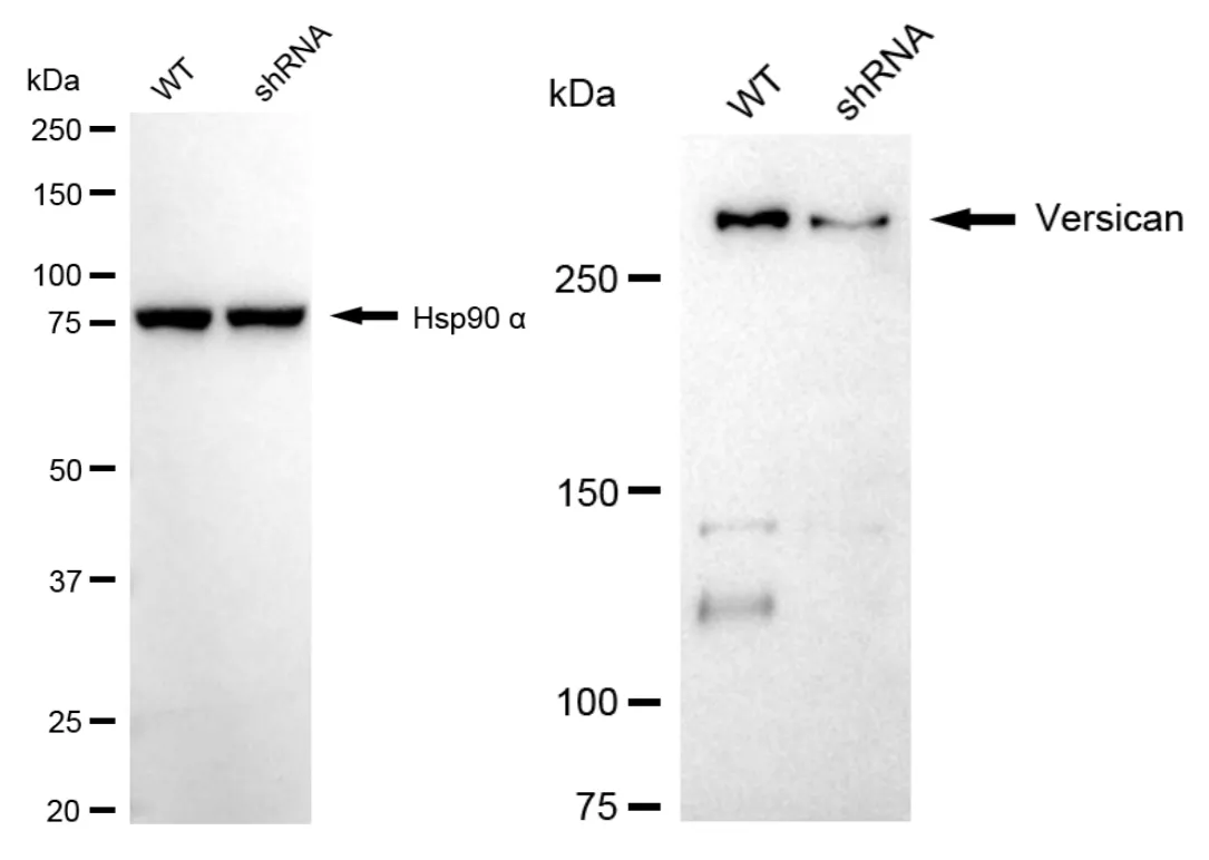 KD-Validated Versican Recombinant Rabbit Monoclonal Antibody
