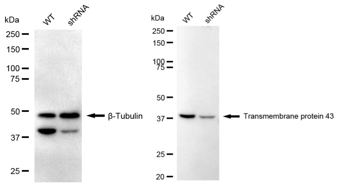 KD-Validated Transmembrane Protein 43 Recombinant Rabbit Monoclonal Antibody