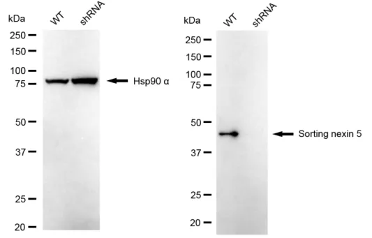 KD-Validated Sorting Nexin 5 Recombinant Rabbit Monoclonal Antibody