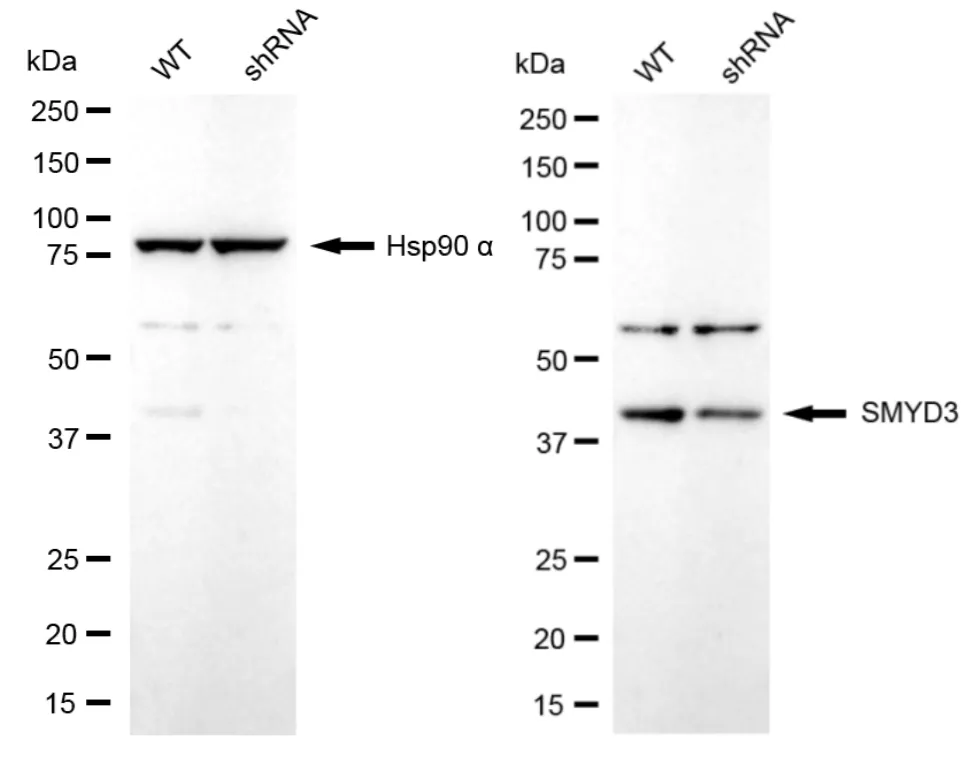 KD-Validated SMYD3 Recombinant Rabbit Monoclonal Antibody