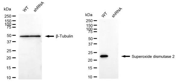 KD-Validated Superoxide Dismutase 2 Recombinant Rabbit Monoclonal Antibody