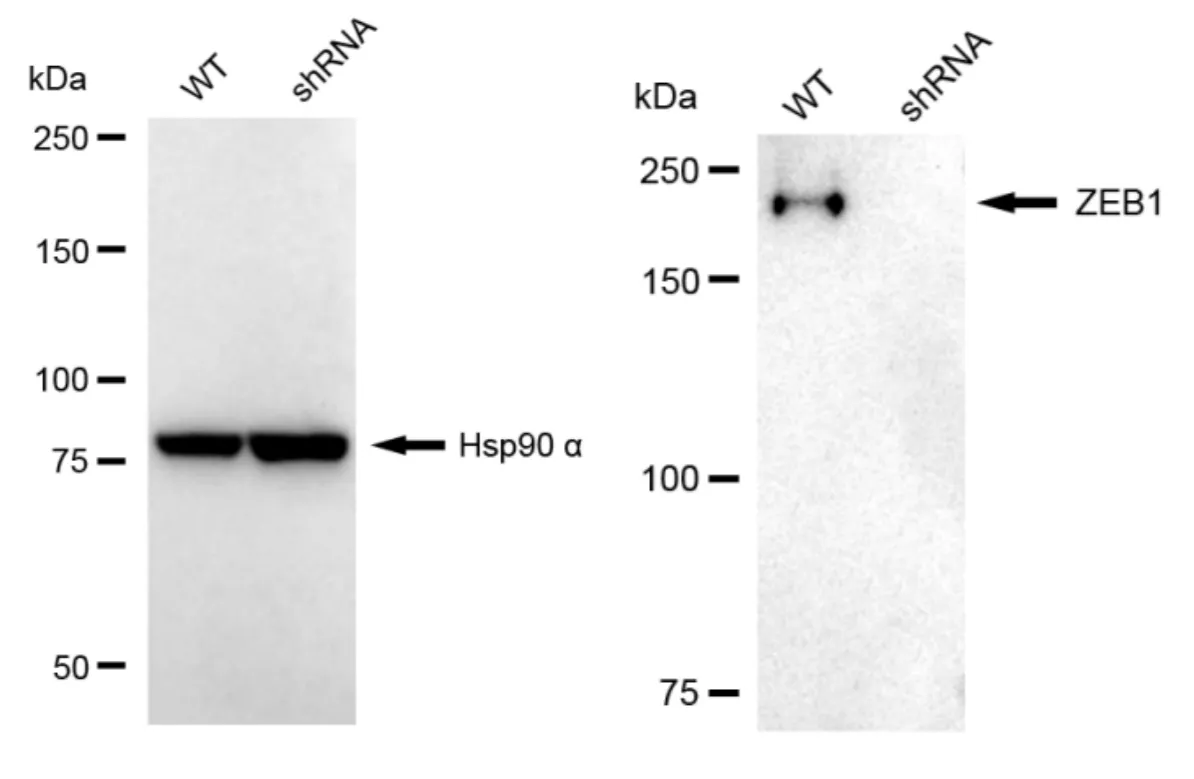 KD-Validated Zinc Finger E-Box Binding Homeobox 1 Recombinant Rabbit Monoclonal Antibody