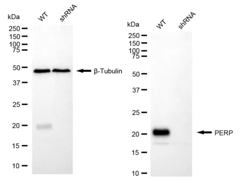 KD-Validated PERP Recombinant Rabbit Monoclonal Antibody