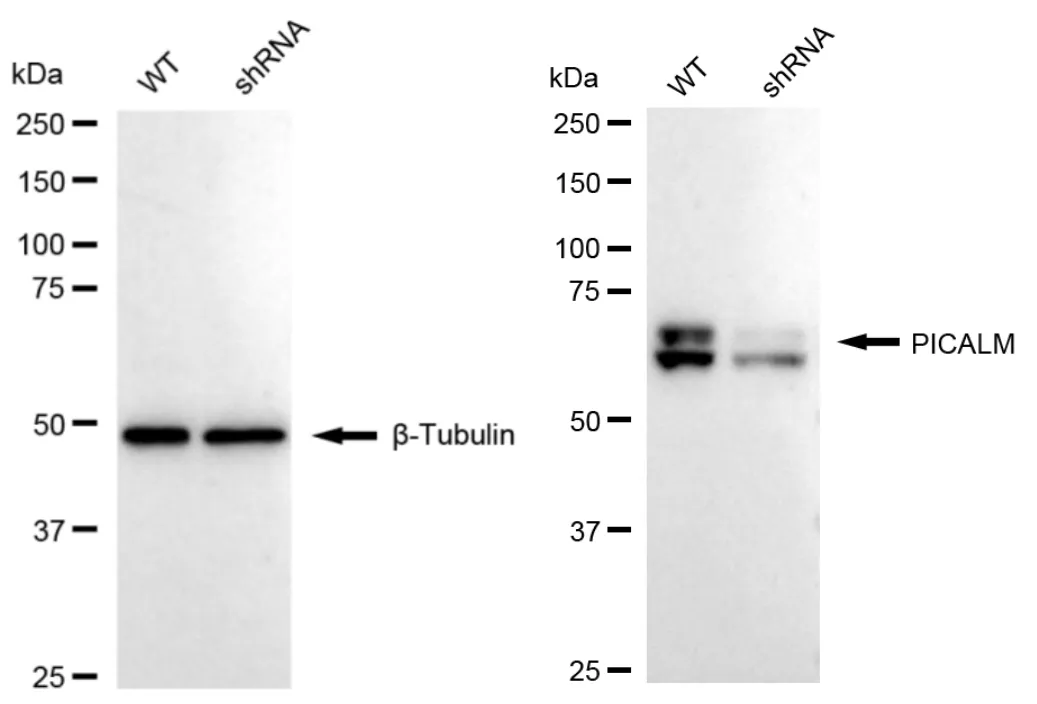 KD-Validated PICALM Recombinant Rabbit Monoclonal Antibody
