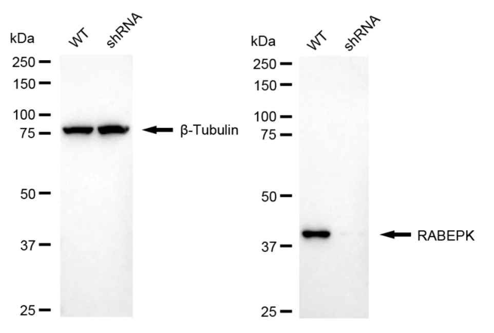 KD-Validated RABEPK Recombinant Rabbit Monoclonal Antibody