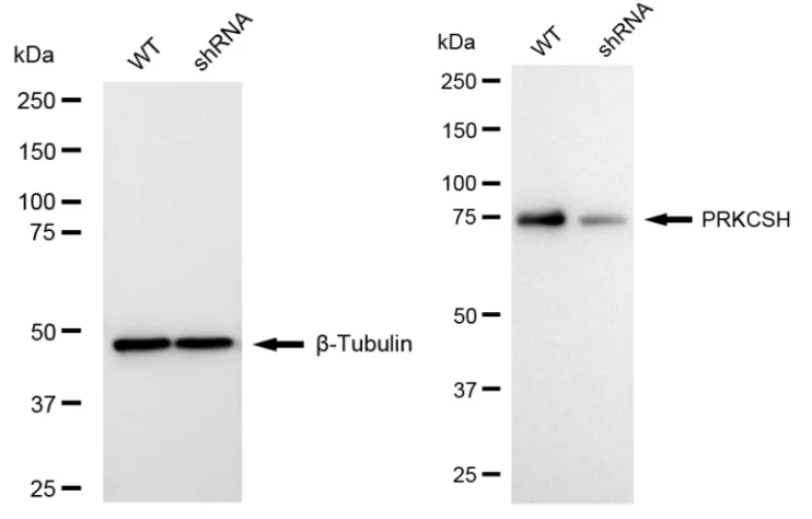KD-Validated PRKCSH Recombinant Rabbit Monoclonal Antibody