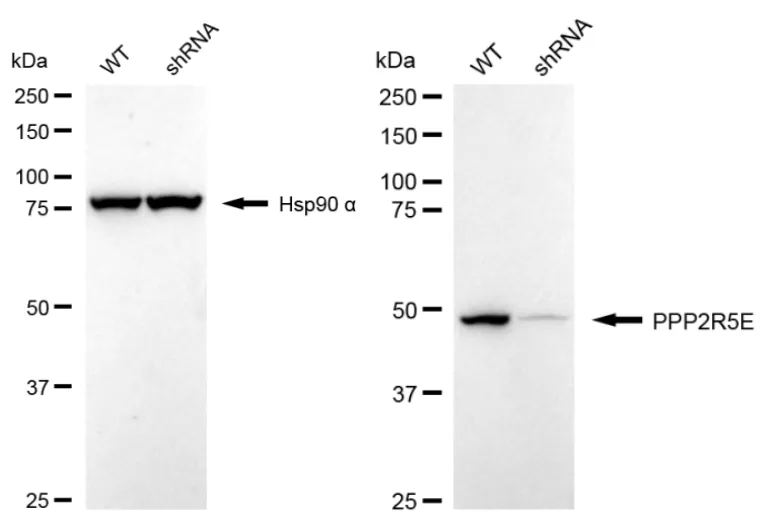 KD-Validated PPP2R5E Recombinant Rabbit Monoclonal Antibody