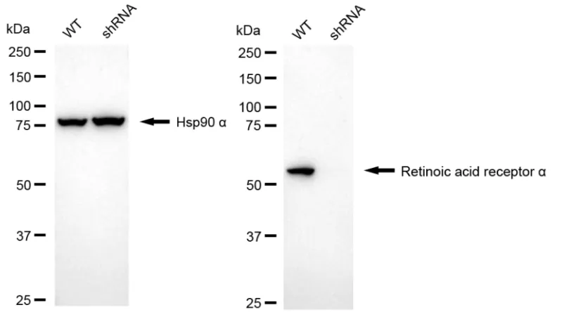 KD-Validated Retinoic Acid Receptor Alpha Recombinant Rabbit Monoclonal Antibody