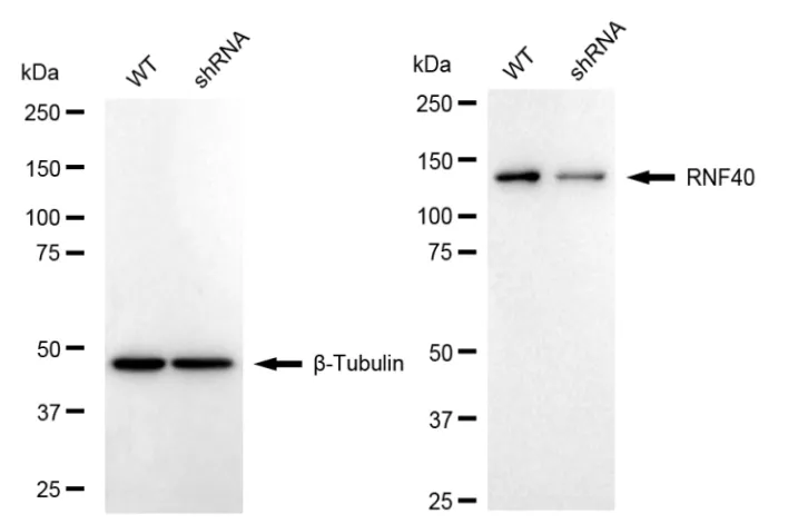 KD-Validated Ring Finger Protein 40 Recombinant Rabbit Monoclonal Antibody