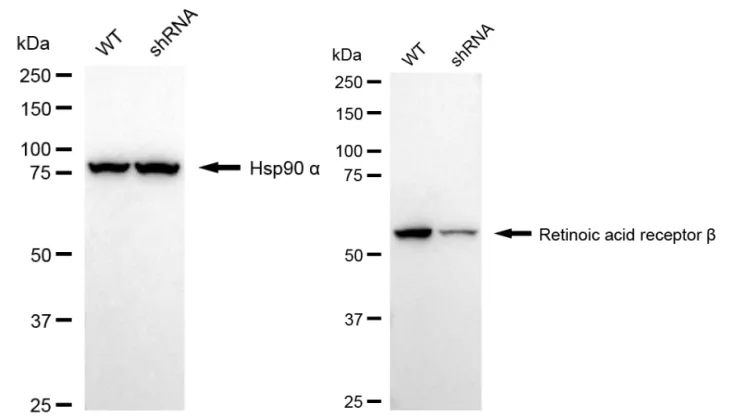 KD-Validated Retinoic Acid Receptor Beta Recombinant Rabbit Monoclonal Antibody